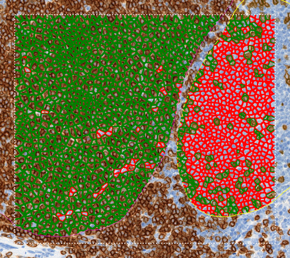 Quantification cellulaire HistoMetrix®
